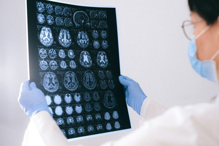 Doctor looking at brain scan