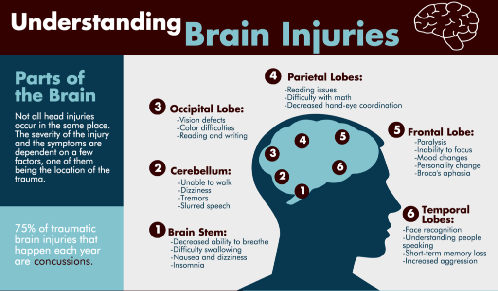 infographic-understanding-brain-injuries-denver-co-lawyers