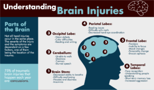 Brain injury attorney infographic