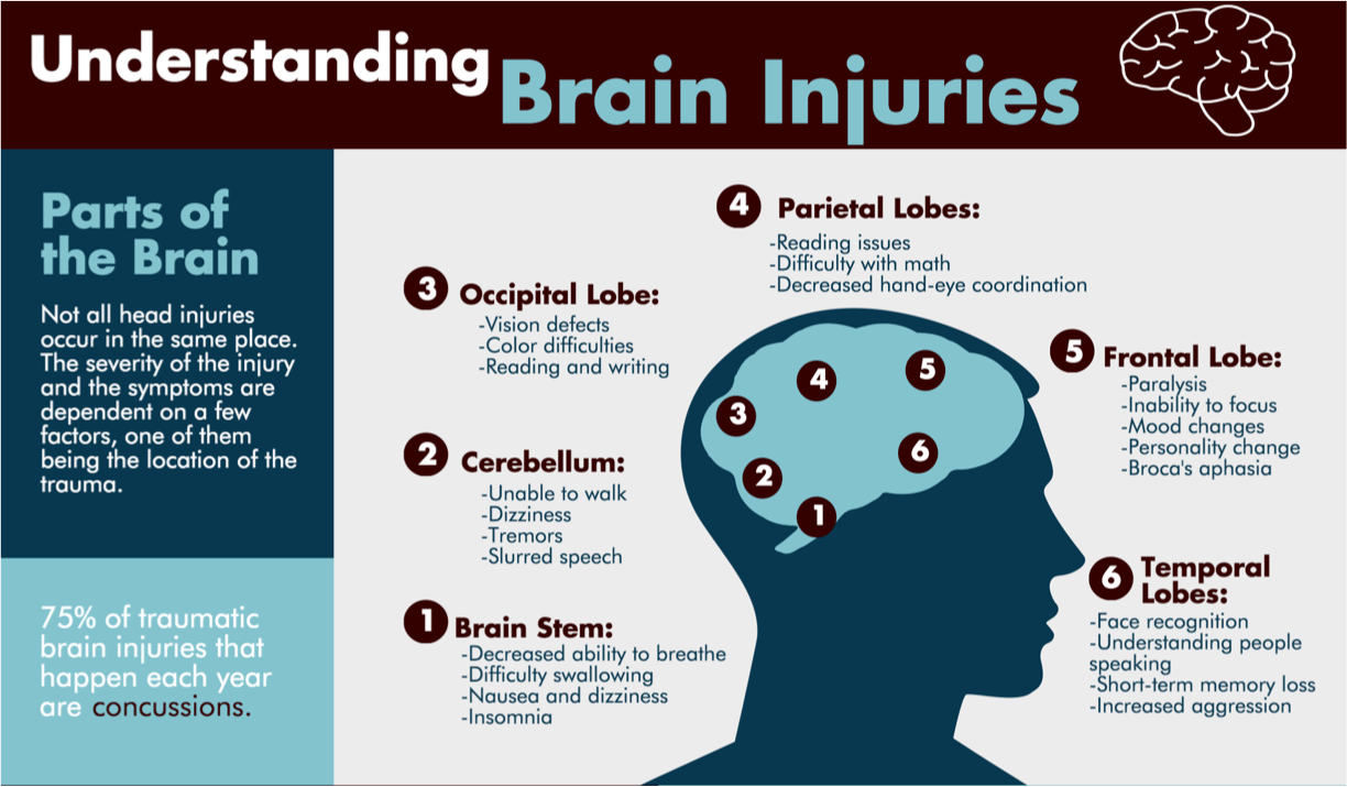 Infographic Understanding Brain Injuries Denver Co Lawyers